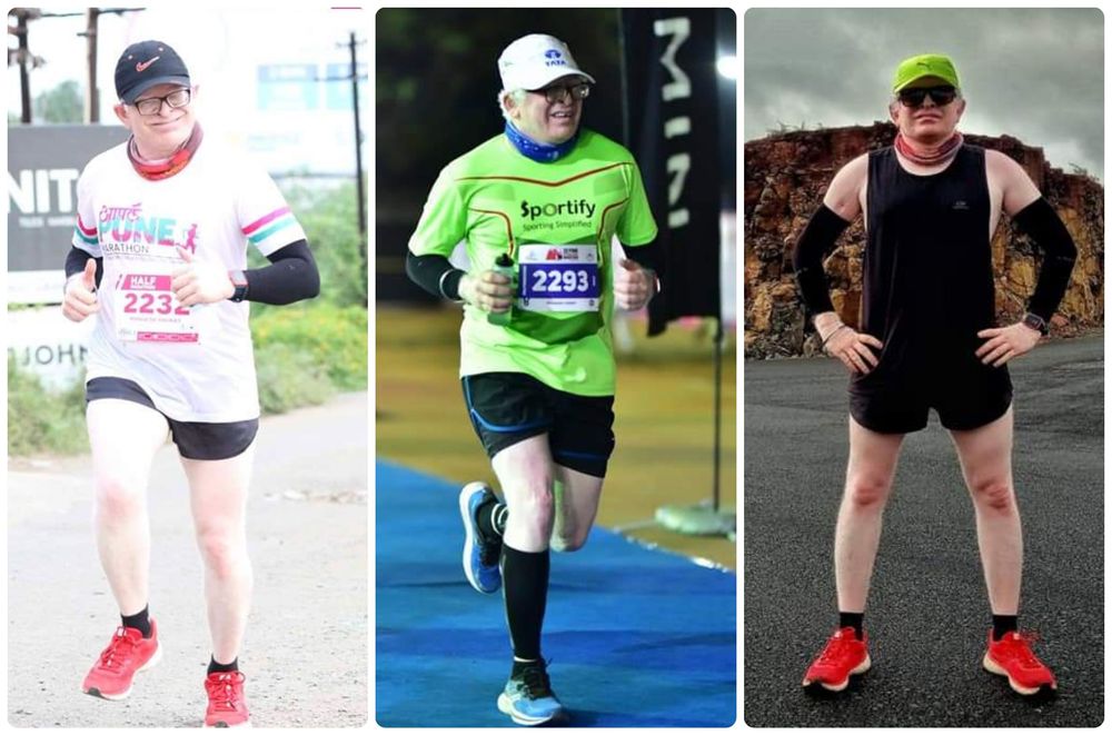  Runner Breaking Albinism Stigma 